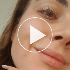 Women sharing their experience with Nanolash